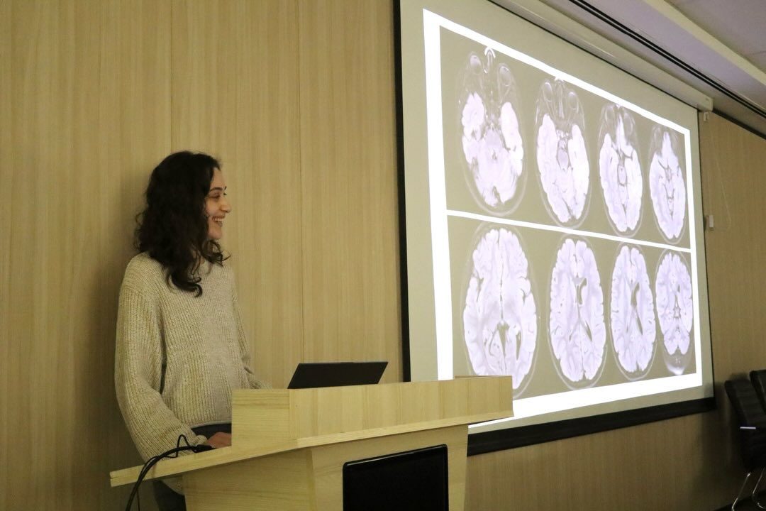 Speaker presenting brain imaging at the International Epilepsy Day event