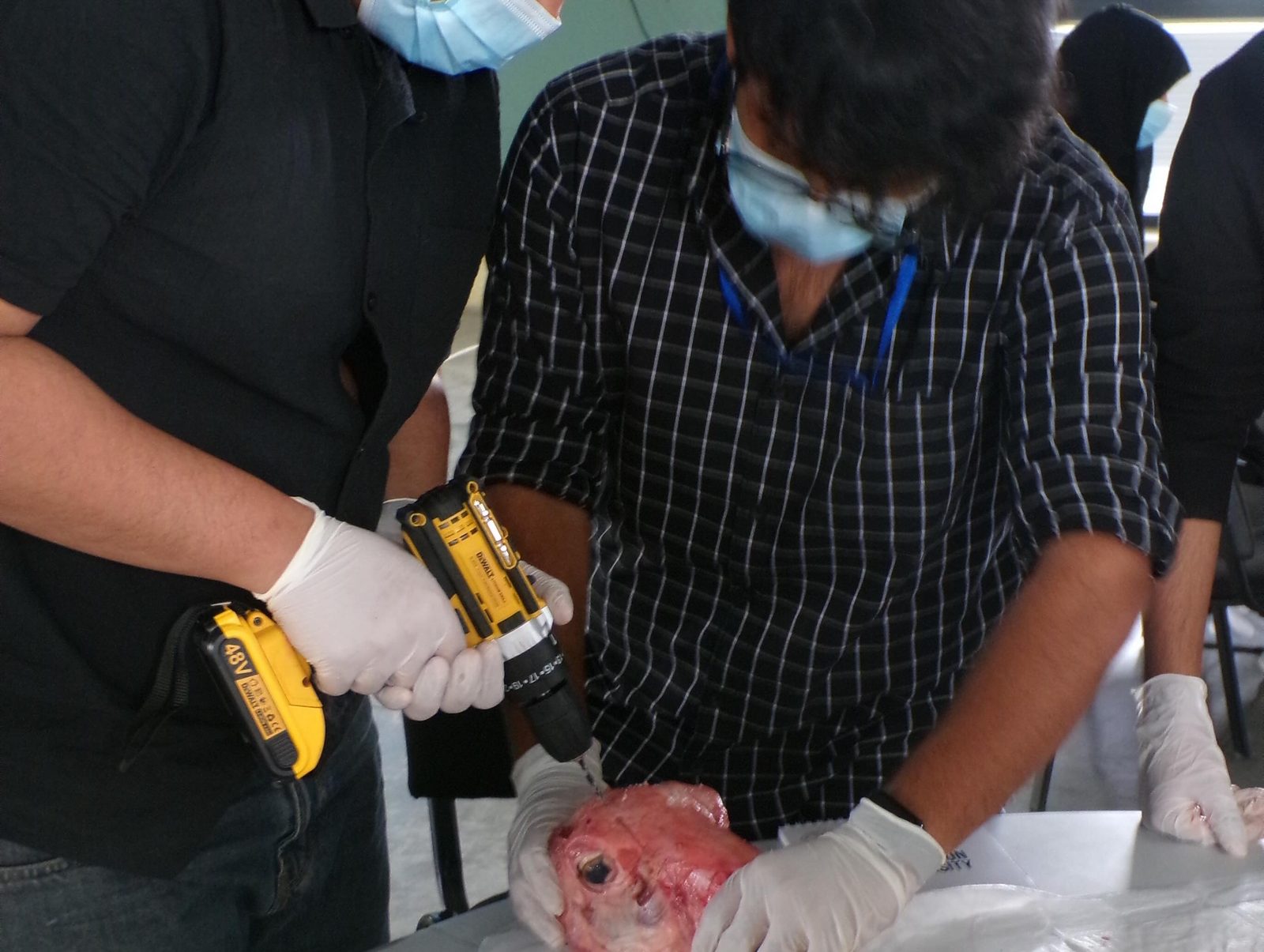 Drilling practice on a specimen at the ventriculostomy masterclass, Dandy Day Spring 2026